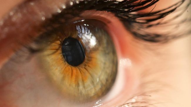 Ukuran Pupil Mata Bisa Deteksi Kecerdasan Seseorang